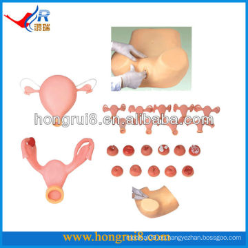 Advanced EVA Gynecologic Simulator, Maniquí de Formación Médica